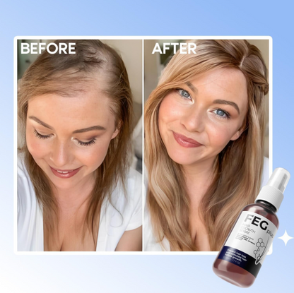 FEGPlus Minoxidil Beard & Hair Growth Serum